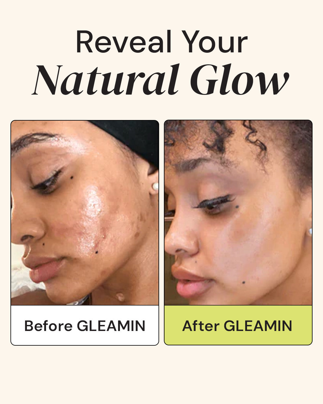 Before and after comparison of a person's face with GLEAMIN product application.