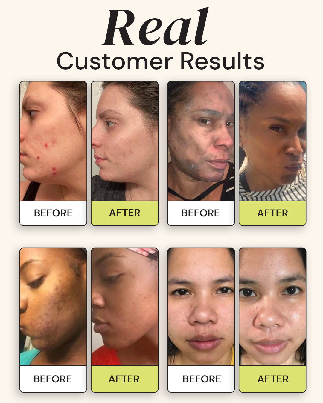Before and after results of a skincare product on multiple customers' faces.